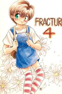 Fracture 4 0
